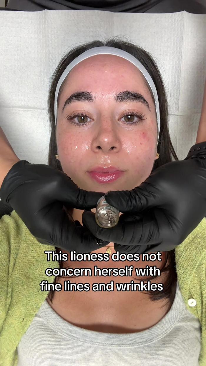 Top post by Skin Laundry