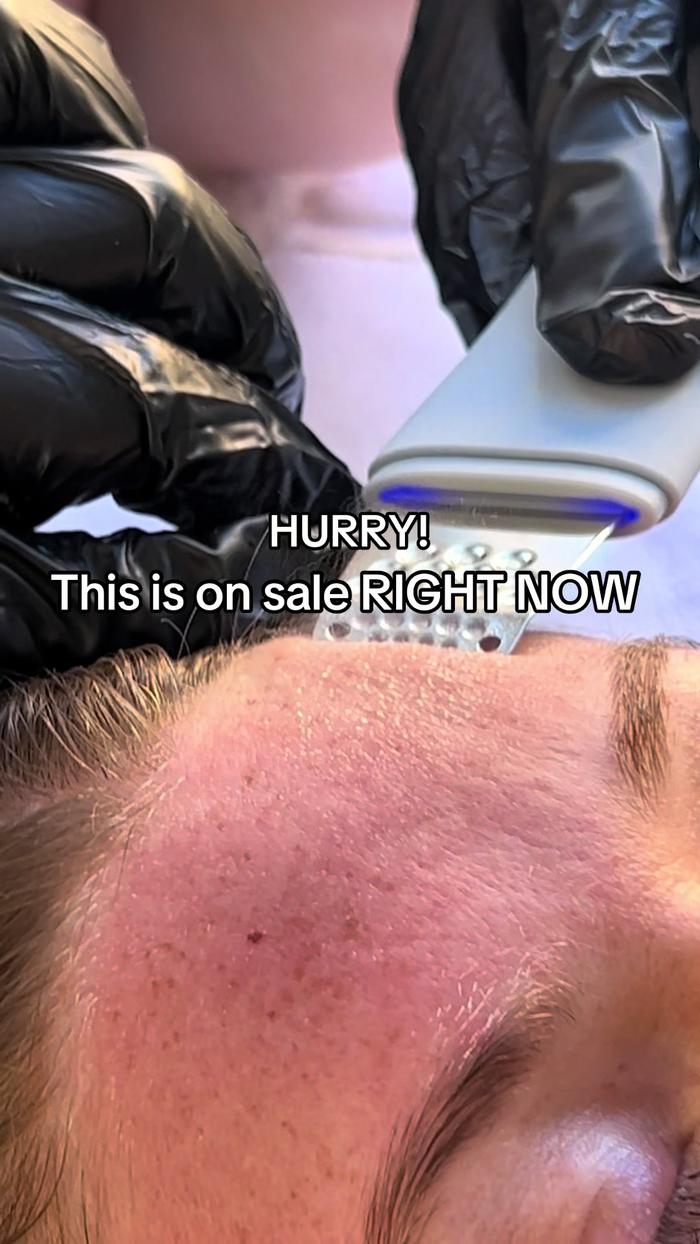 TikTok Post Thumbnail