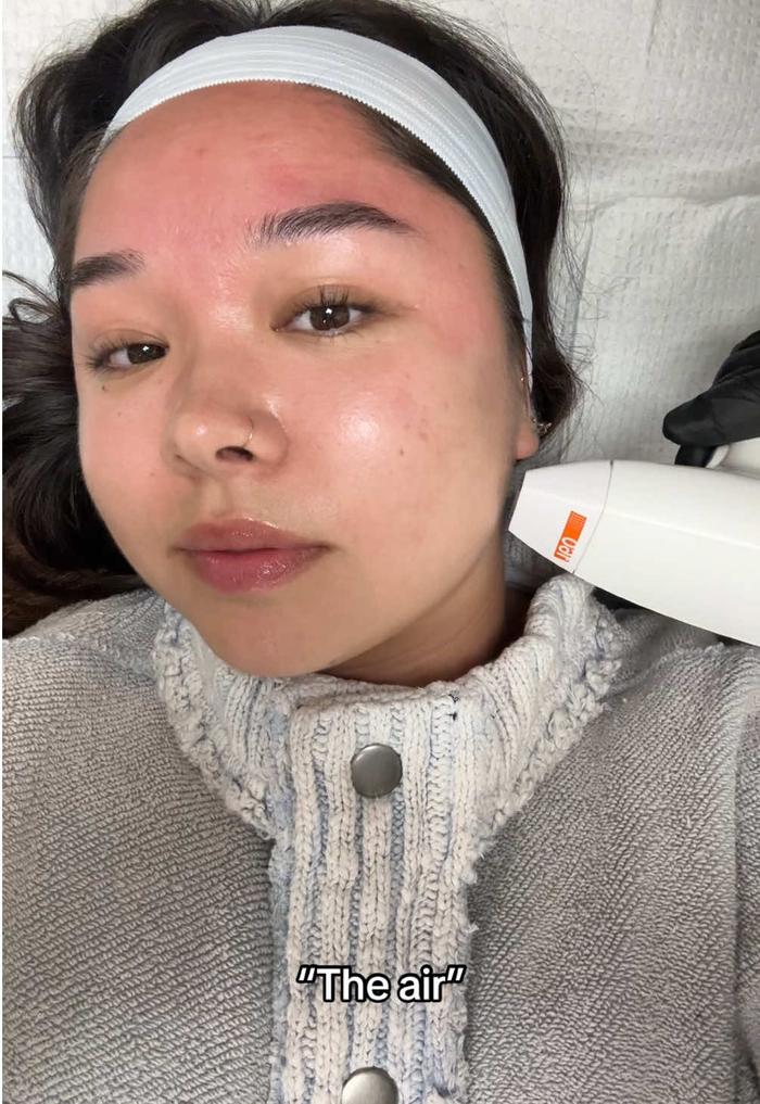 Post by skinlaundryusa