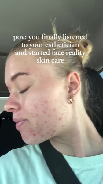 Post by facerealityskincare