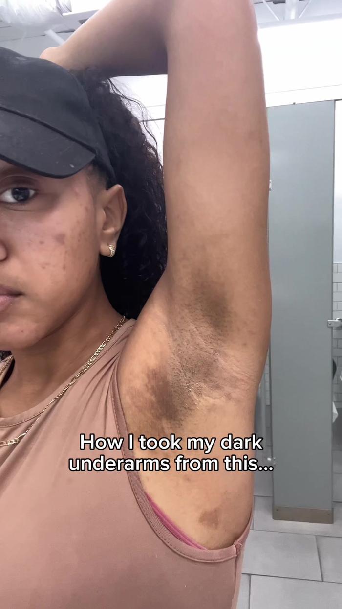 TikTok Post Thumbnail