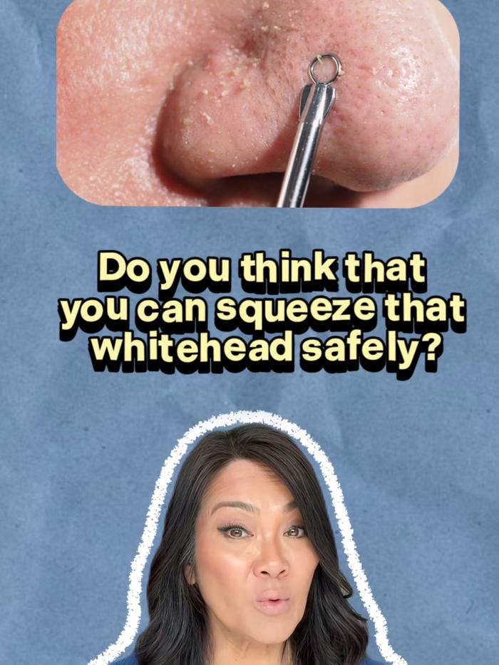 TikTok Post Thumbnail