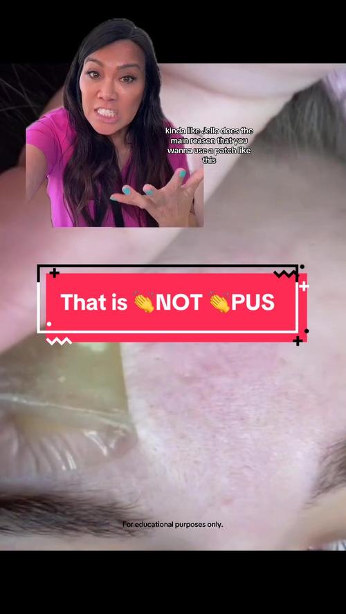 Post by slmdskincare