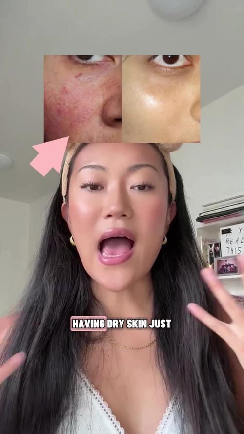 Top post by Skindeva