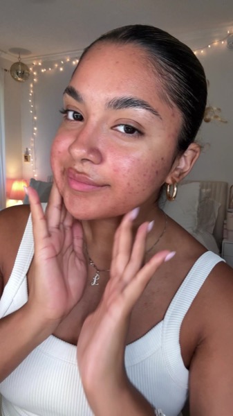 Post by muradskincare