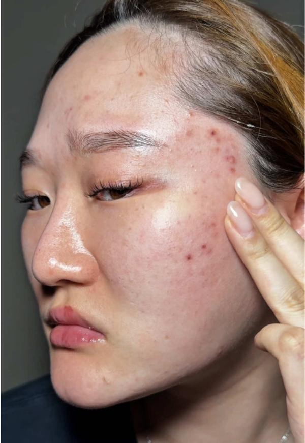 Post by saturdayskin