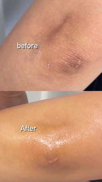 Post by somebymi.official