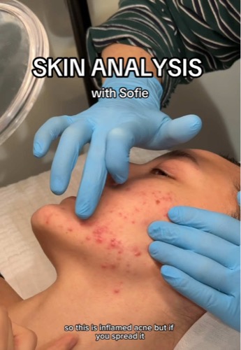 Post by sofiepavittface