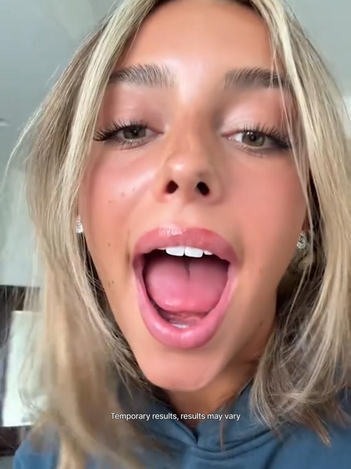 TikTok Post Thumbnail