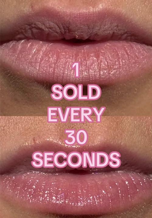 Top post by Lanolips