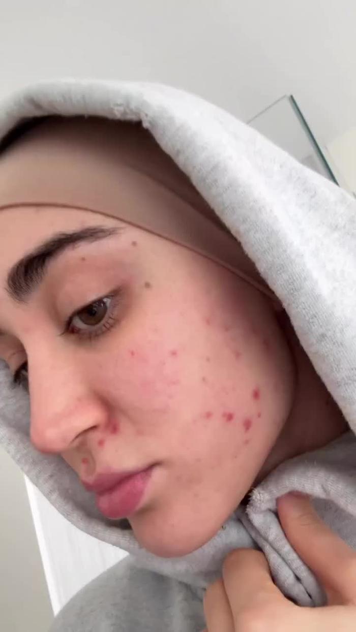 Post by facerealityskincare